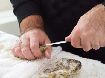 Blessures de la main pendant les fêtes